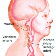 Verlauf der hinteren Halsschlagader (Vertebralarterie) durch die HWS